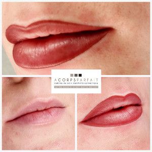 Maquillage permanent complet des lèvres